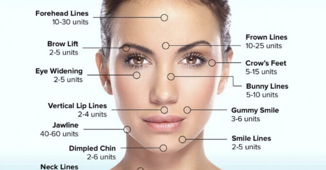 Neuromodulators (Botox) Injections